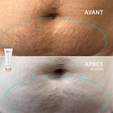 Le Gel Régénérant Derma Collagen Avantageux