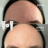 Le Gel fermeté Derma Elastin Avantageux
