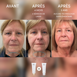 Le Gel fermeté Derma Elastin Avantageux